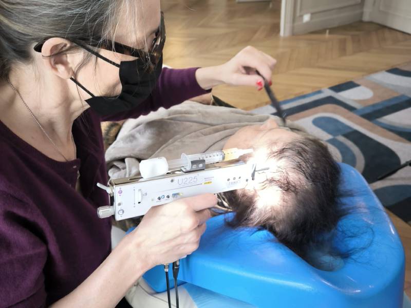 injection prp cheveux 2