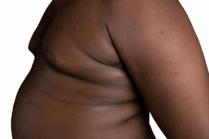 refaire les seins dr ktorza chirurgie esthetique medecine esthetique paris refaire les seins dr ktorza chirurgie esthetique medecine esthetique paris