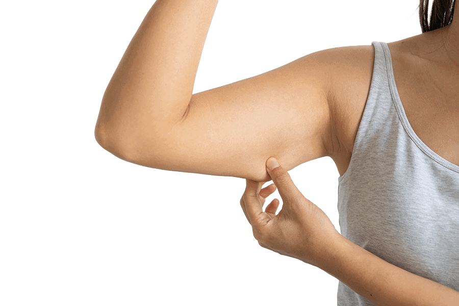 brachioplastie lifting bras chirurgie esthetique femme dr thierry ktorza specialiste medecine esthetique paris