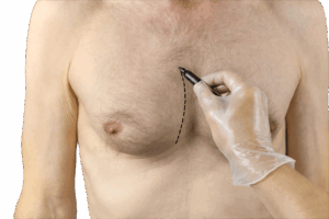 refaire les seins dr ktorza chirurgie esthetique medecine esthetique paris refaire les seins dr ktorza chirurgie esthetique medecine esthetique paris
