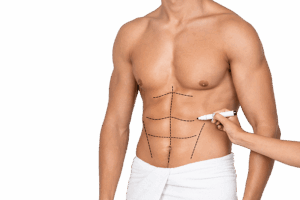 refaire les seins dr ktorza chirurgie esthetique medecine esthetique paris refaire les seins dr ktorza chirurgie esthetique medecine esthetique paris
