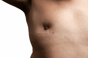 refaire les seins dr ktorza chirurgie esthetique medecine esthetique paris refaire les seins dr ktorza chirurgie esthetique medecine esthetique paris