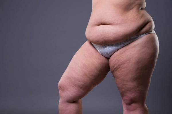 cout-plastie-abdominale