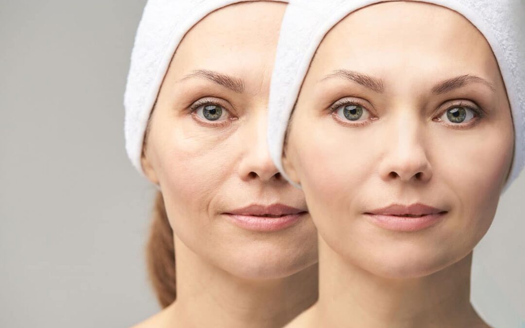 7 solutions pour rajeunir le visage sans chirurgie